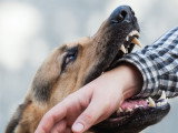 Un chien en train de mordre le bras d'une personne