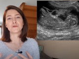 De la saillie à la mise bas : la reproduction chez la chienne