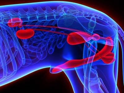 Gastric cancer ke lakshan Oncologie Timisoara Porumbescu