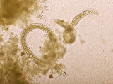 Vue au microscope d'un ver du coeur