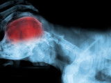 Radiographie d'une inflammation du cervelet d'un chien