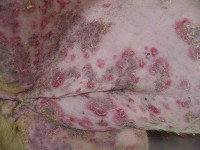Pemphigus foliacé