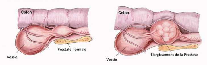 prostate chien anatomie
