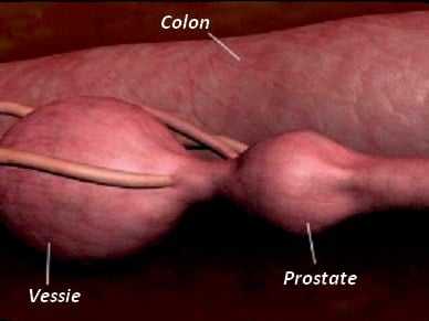 opération prostate chien