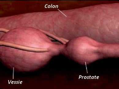 abces de la prostate chez le chien