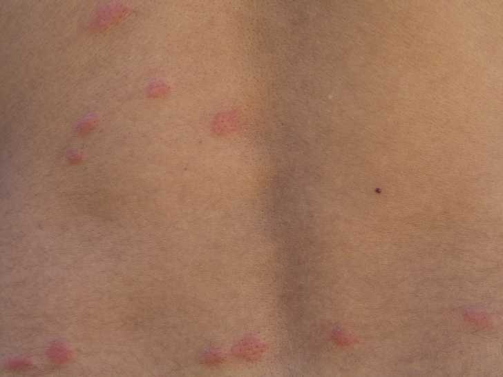 Mon Chien A Des Puces Symptomes Traitement Et Prevention