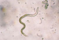 Un ver ascaris au microscope