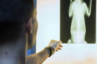 Les causes possibles de boiterie chez le chien