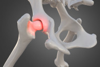 Des os de chien avec une dysplasie de la hanche