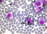 Vue microscopique de bactéries Ehrlichia
