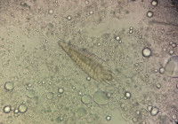 Vue au microscope de Demodex dans la peau d'un chien