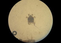 Vue microscopique sur le parasite de la gale