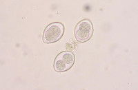 Parasites unicellulaires nommés Gardia intestinalis
