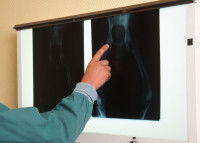 Un vétérinaire examine la radiographie d'un chien