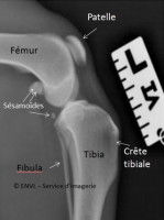 La rotule et son rôle dans la motricité du chien