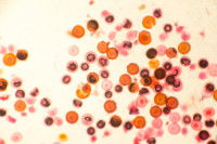 Oeufs de ténia vus au microscope