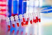 Série d'échantillons de sang