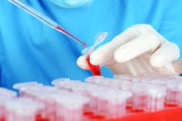 Les examens de biochimie sanguine