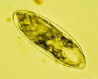 Un oeuf de puce sur le point d'éclore vu au miscrocope