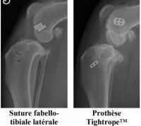 Radio avant après de la patte d'un chien avant le placement d'une prothèse