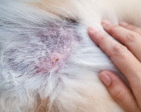 La séborrhée secondaire