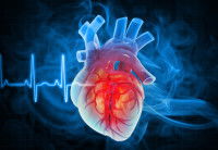 Insuffisance cardiaque