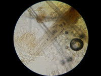 Vue microscopique des champignons responsables de la teigne