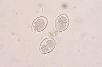 Parasites unicellulaires nommés intestinalis