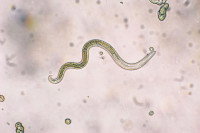 Vue au microscope d'un ascaris, Toxocara canis