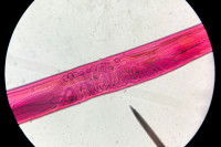 Vue microscopique du nématode Ankylostome caninum