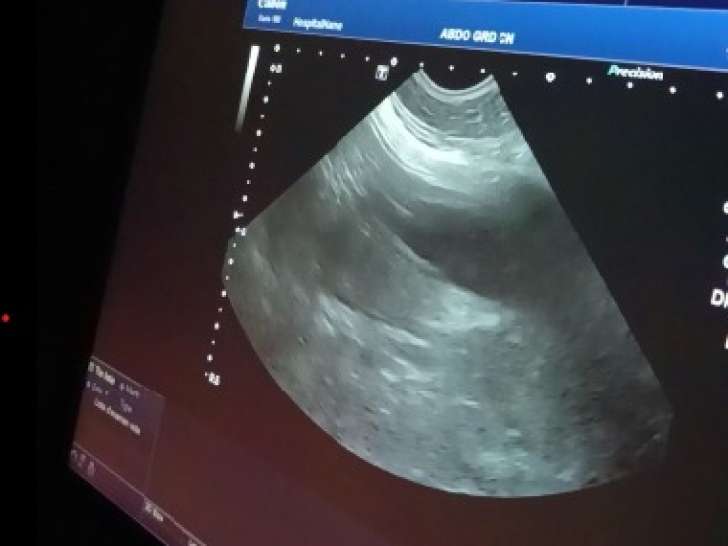 Echographie de Twix